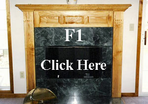 F1 Mantle Kit